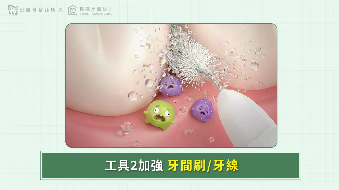 台南全口重建推薦盧佳豪醫師