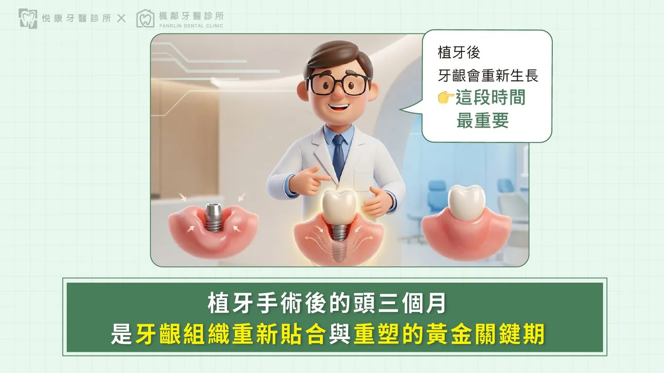 台南全口重建推薦盧佳豪醫師