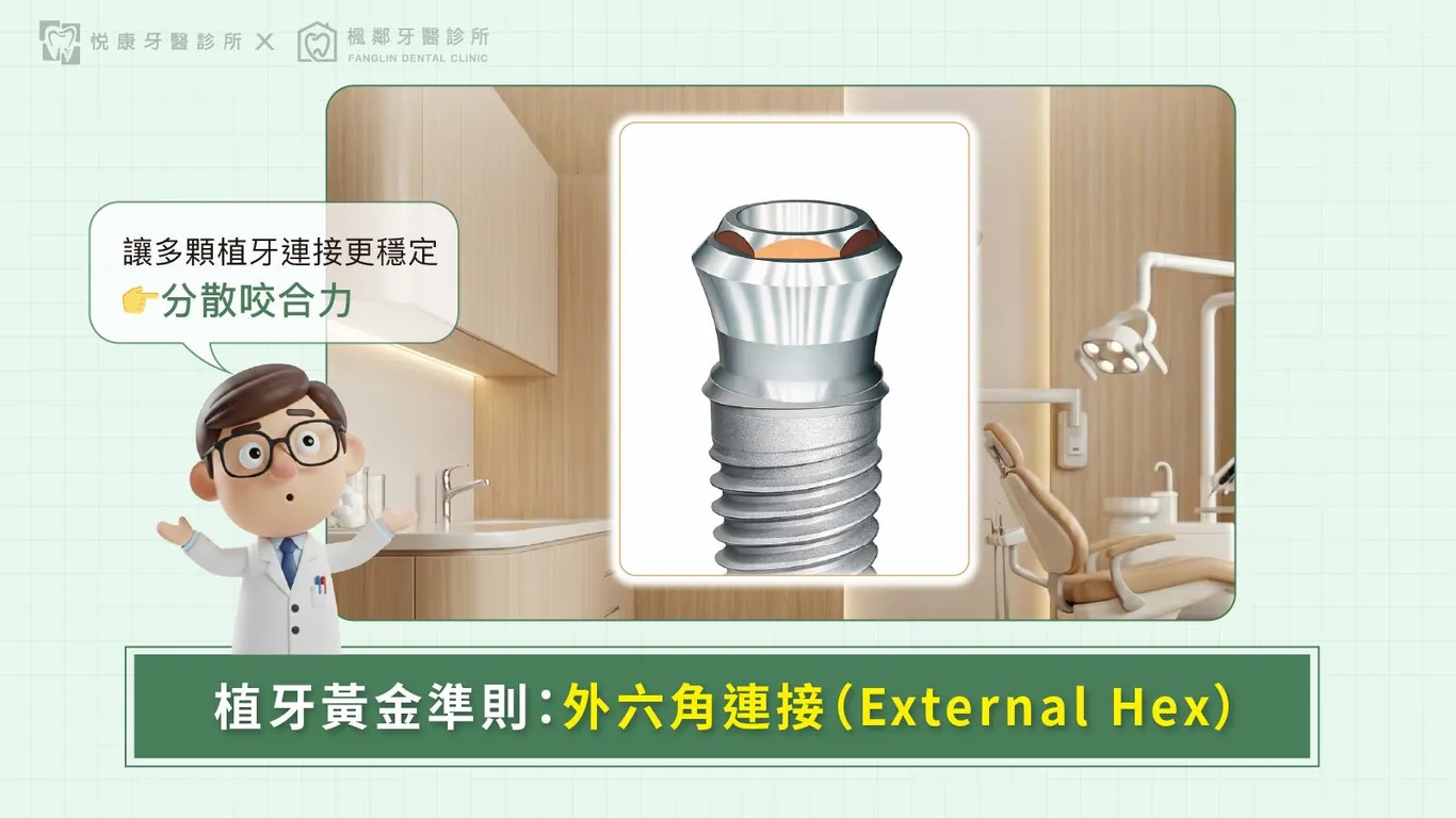 台南全口重建推薦盧佳豪醫師