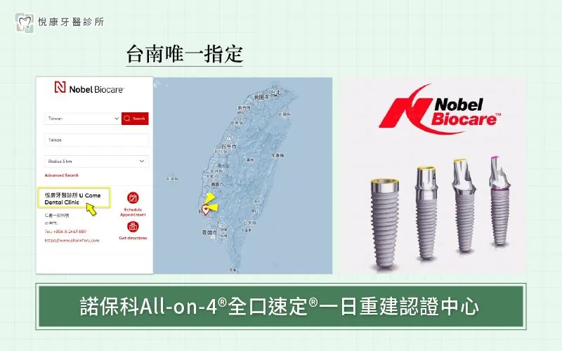 國際頂級植體品牌與原廠認證