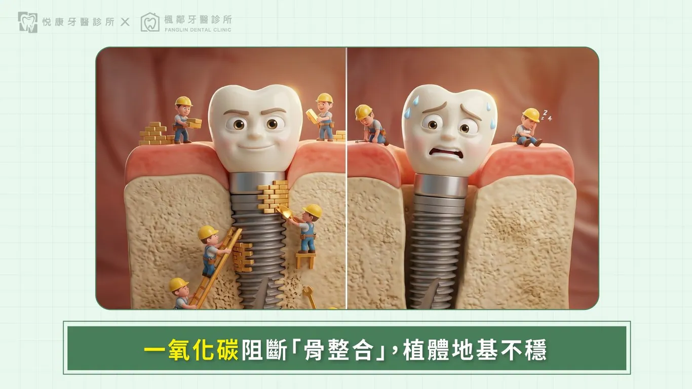 台南全口重建推薦盧佳豪醫師