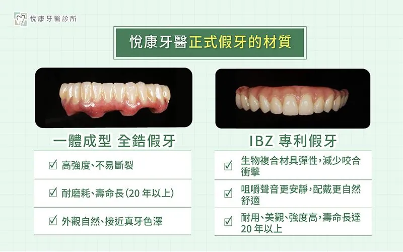 頂級假牙材質與工藝
